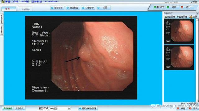 巨渺动物内窥镜影像工作站-巨渺动物内窥镜影像工作站下载 v2016官方版