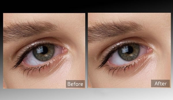 Retouch4me Eye Vessels-图片处理工具-Retouch4me Eye Vessels下载 v0.9.9.3官方版