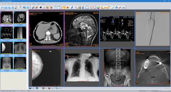 Sante DICOM Editor-DICOM编辑器-Sante DICOM Editor下载 v7.8.6官方版